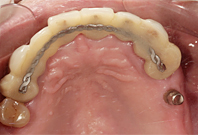 ca_32