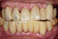 ca_33