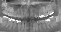 ca_40