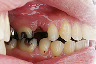 ca_51